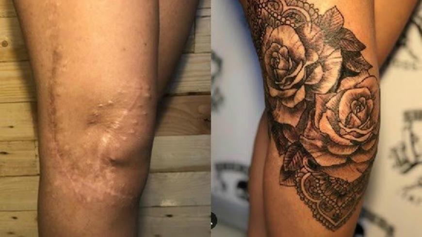 Woman covers severe burns with inspiring tattoo masterpiece
